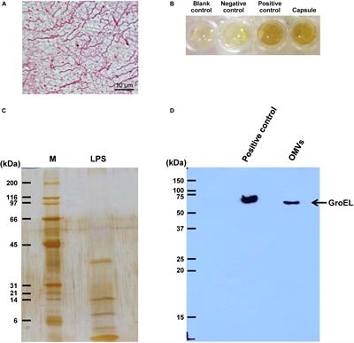 Flagellum Is Responsible for Promoting Effects of Viable Escherichia coli on Calcium Oxalate Crystallization, Crystal Growth, and Crystal Aggregation